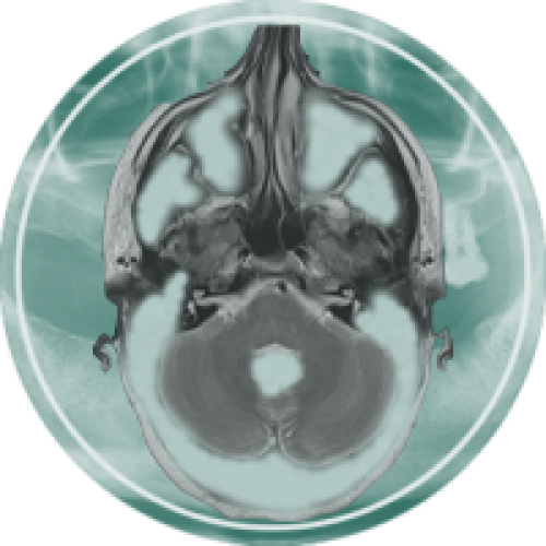 محصولات راینوپلاستی
