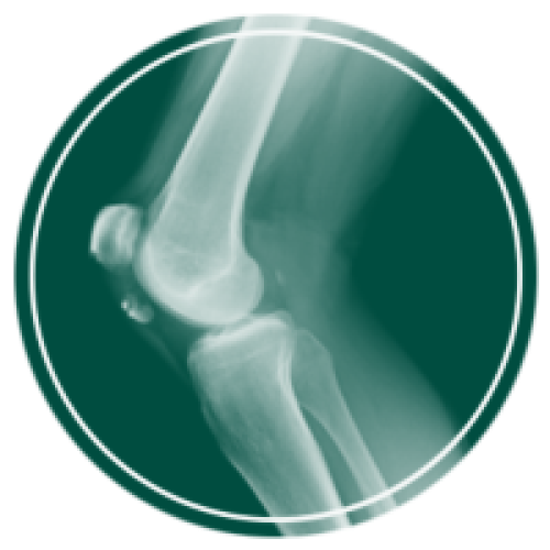 محصولات ارتوپدی