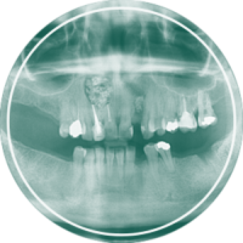 محصولات دندانپزشکی