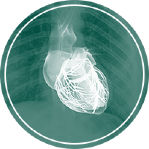 محصولات قلبی عروقی