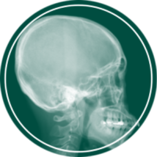 محصولات مغز و اعصاب